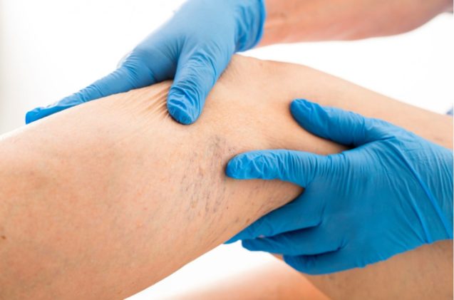 Судинна хірургія